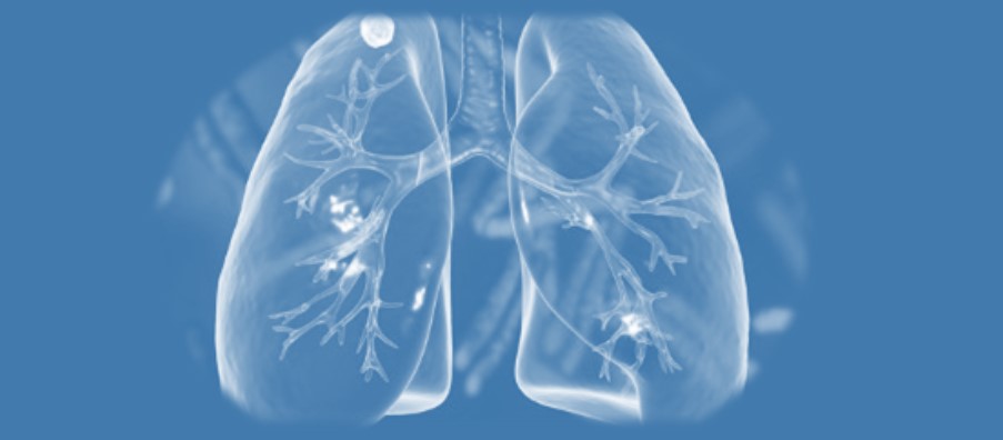 La evidencia científica respalda la efectividad del método de Qigong Baduanjin en la mejora del estado físico y psicológico de pacientes con nódulos pulmonares OVE